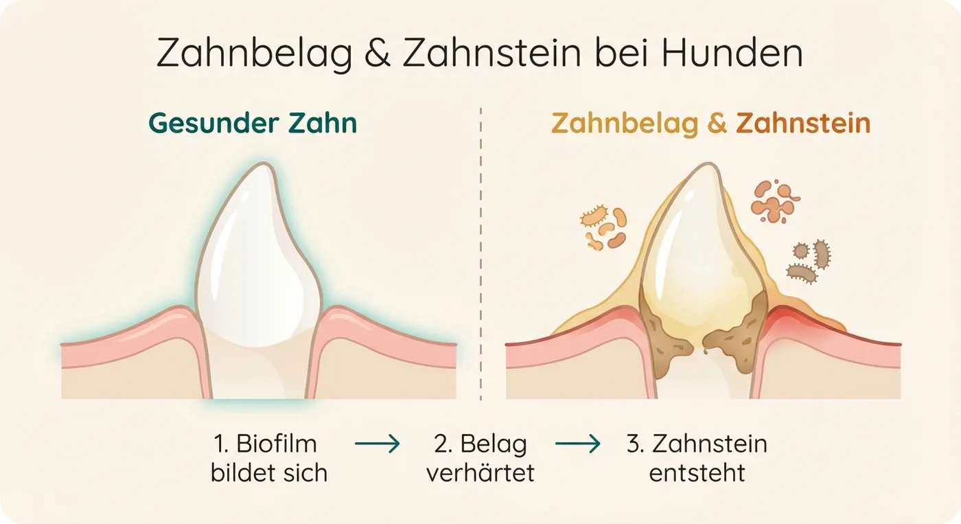Infografik: Biofilm wird zu Zahnstein — 24h bis zur Mineralisierung